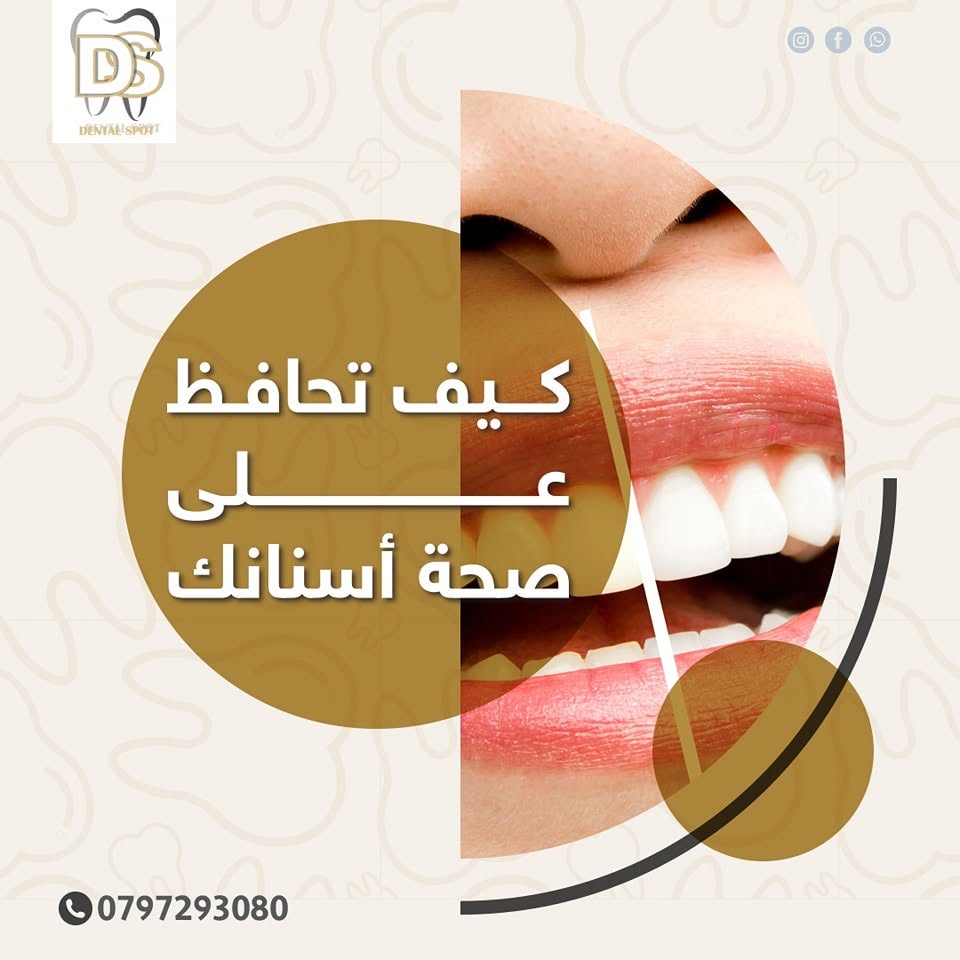 حشوات تجميلية بلون طبيعي مطابق للسن