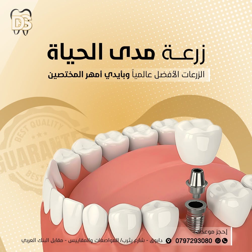 زراعة الأسنان في عيادة Dental Spot بدابوق، عمّان