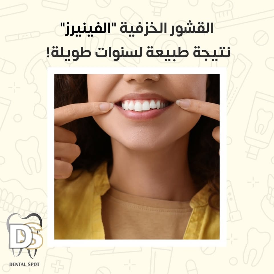 علاج وتجميل اللثة في عيادة Dental Spot بدابوق