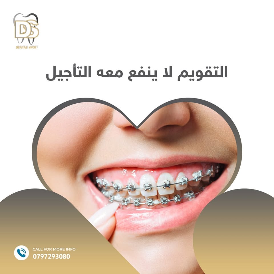 تقويم أسنان في عيادة Dental Spot، عمّان